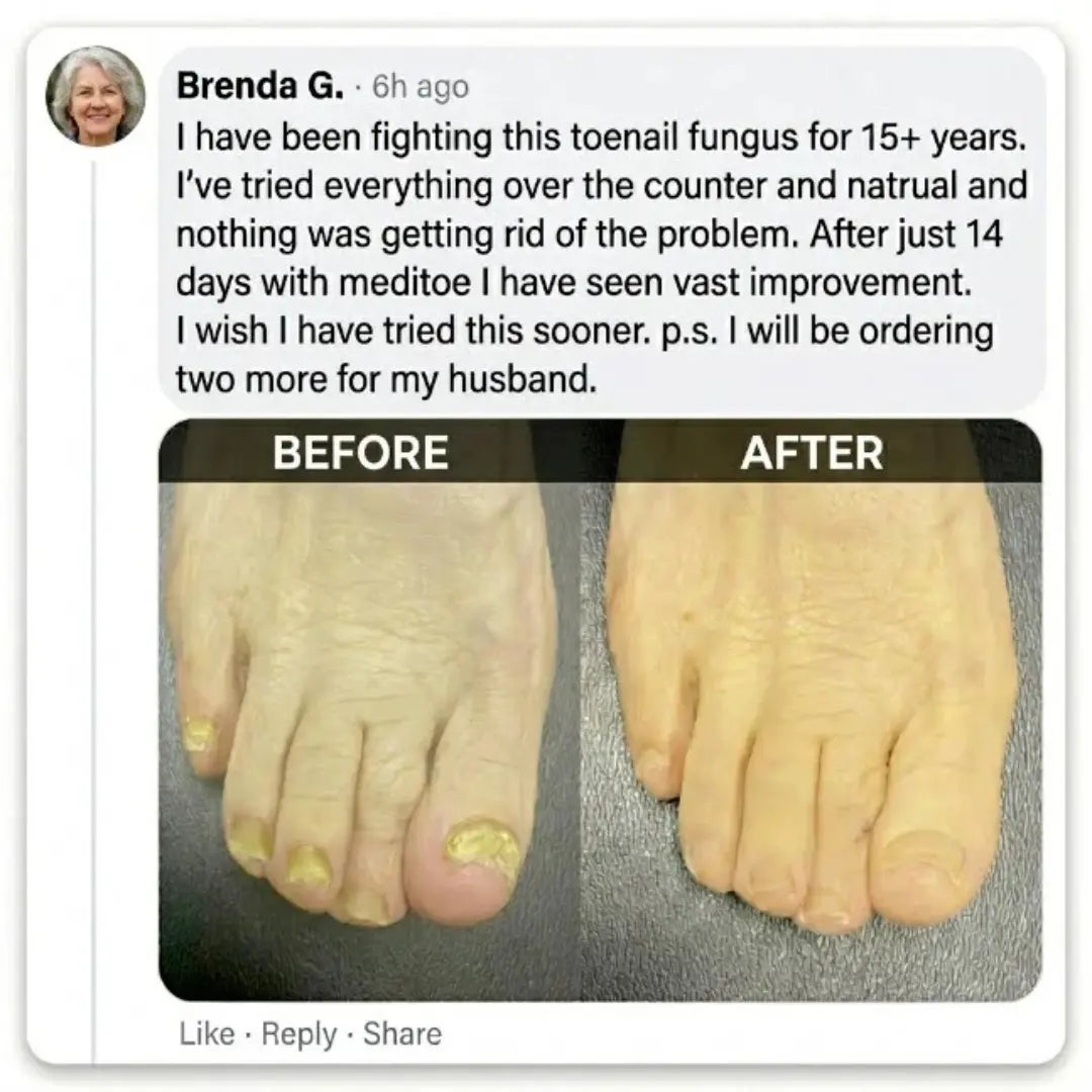 MediToe™ Toenail Fungus Treatment